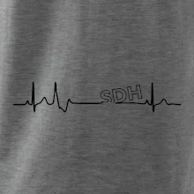 SDH EKG SDH EKG